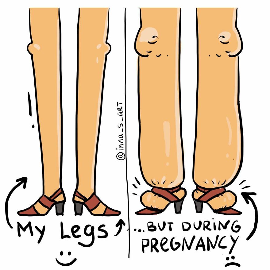 comics about a comparing her legs during pregnancy
