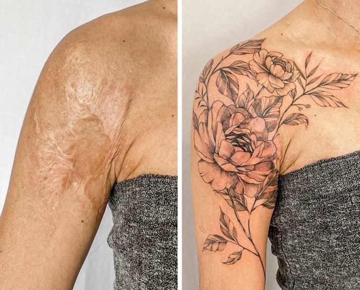 scar cover up tattoo