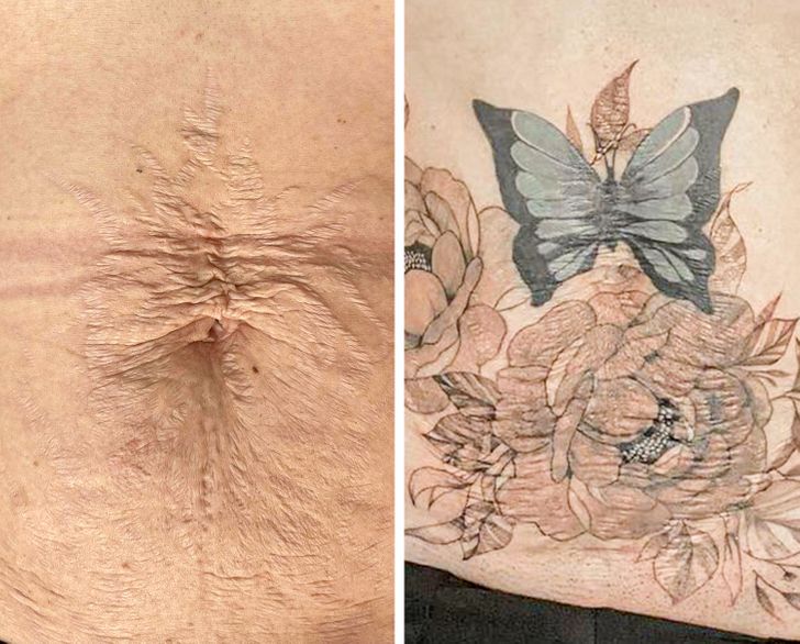 scar cover up tattoo