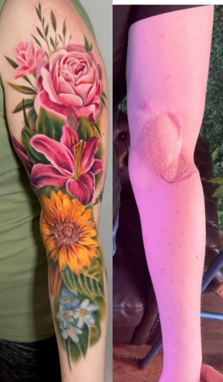 scars cover-up