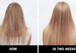 fast hair growth