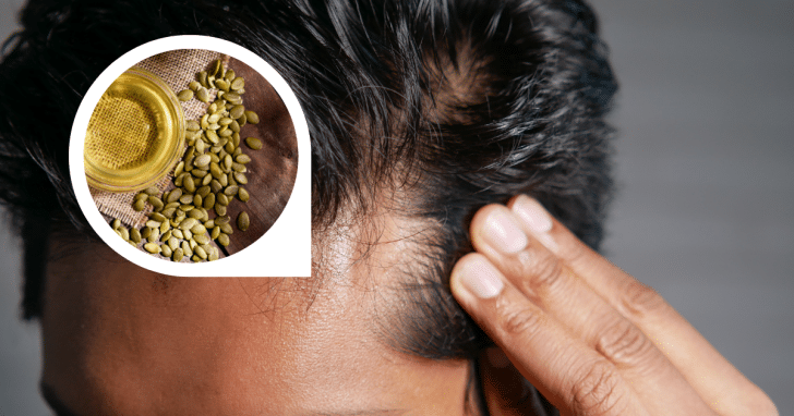 Hair Loss