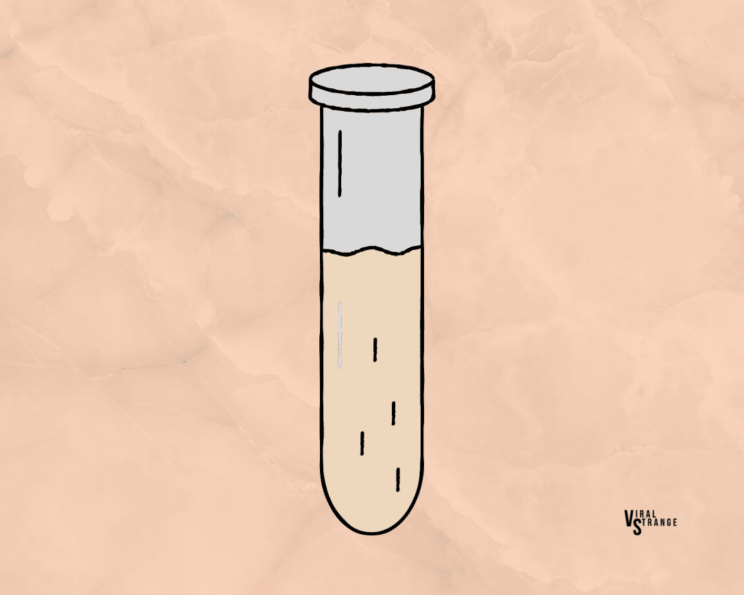 Urine Color What Does It Say About Your Health