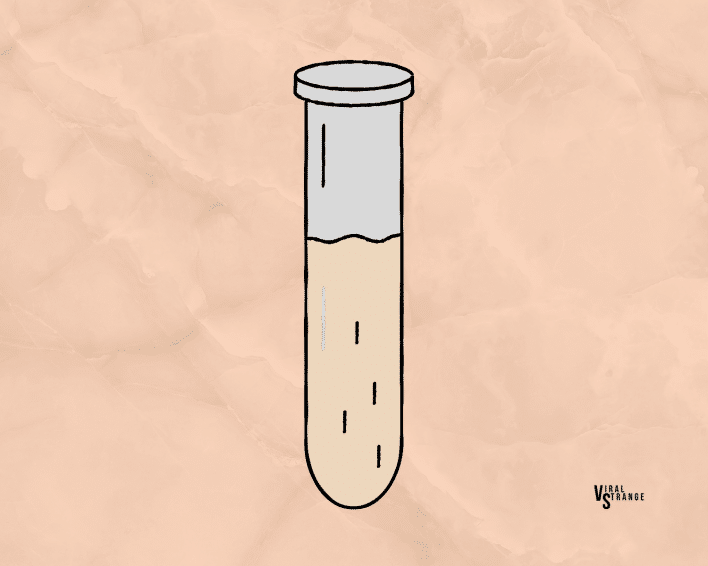 Urine Color What Does It Say About Your Health