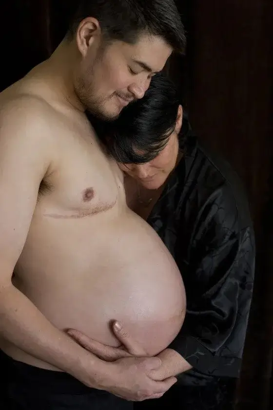 World's First Pregnant Man