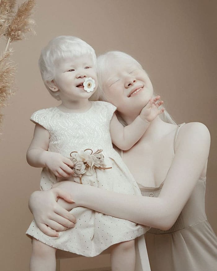 Albino Sisters