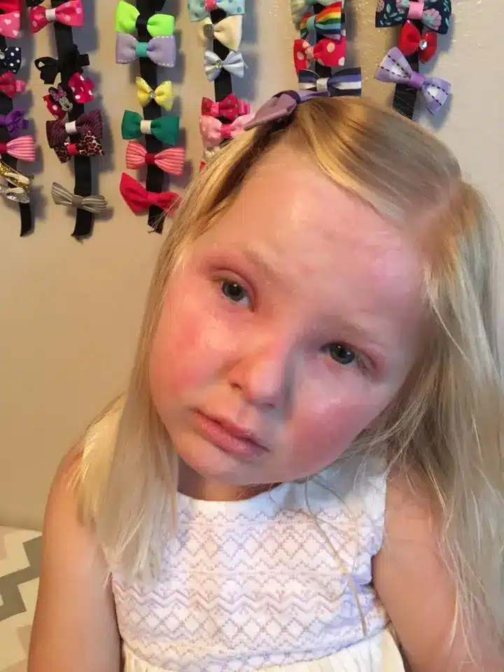 Dad Reacts Over Sick Daughter