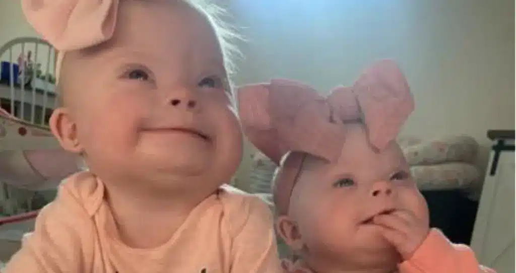 Rare Down Syndrome Twins