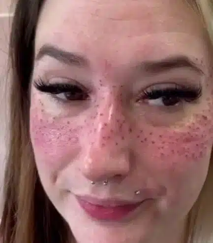 Freckle Tattoos