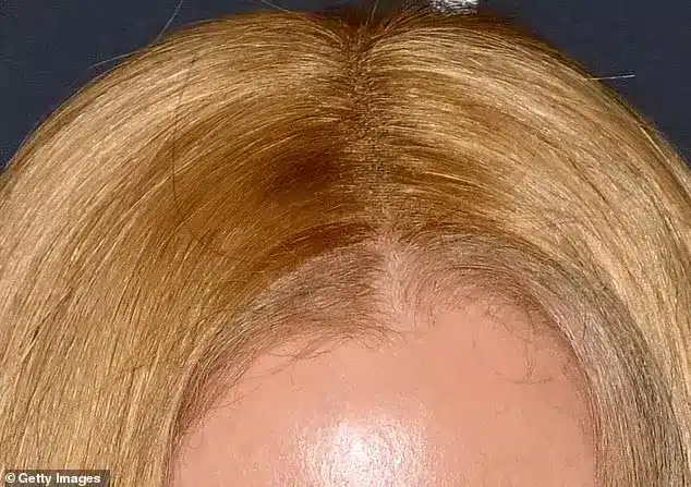 Wig