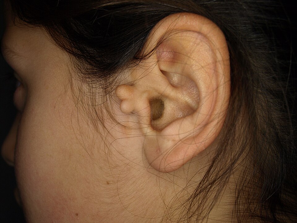 ear health