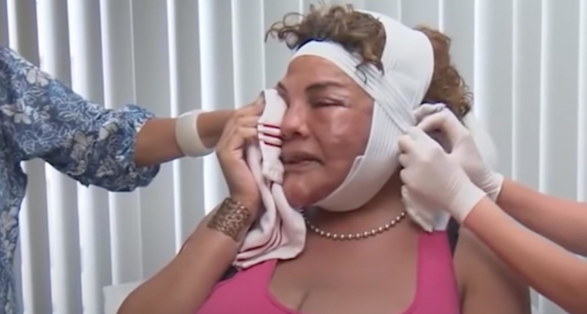 Rajee Narinesingh Reveals Shocking Surgery Story of Her 'Cement Face'