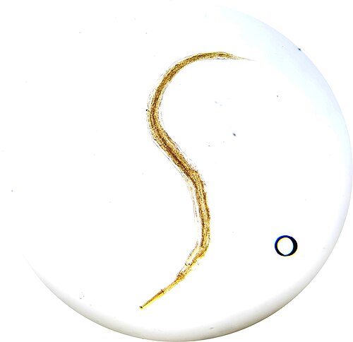 Pinworms