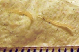 Pinworms